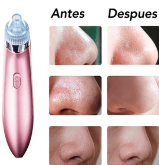 ClearSkin Pro®  Elimina espinillas y puntos negros al instante